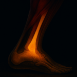 Achilles Total Recovery: The Science, Sacred Geometry, and Advanced Energetics Behind a Next-Generation Healing Program